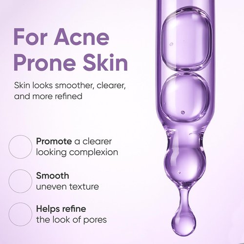 AOBBIY Azelaic Acid Serum for Face – Redness-Soothing Facial Serum with Niacinamide & Hyaluronic Acid, Gentle After-Spot Care for Sensitive-Looking Skin, 30 ml / 1.01 fl. oz. (1 Fl Oz (Pack of 1))