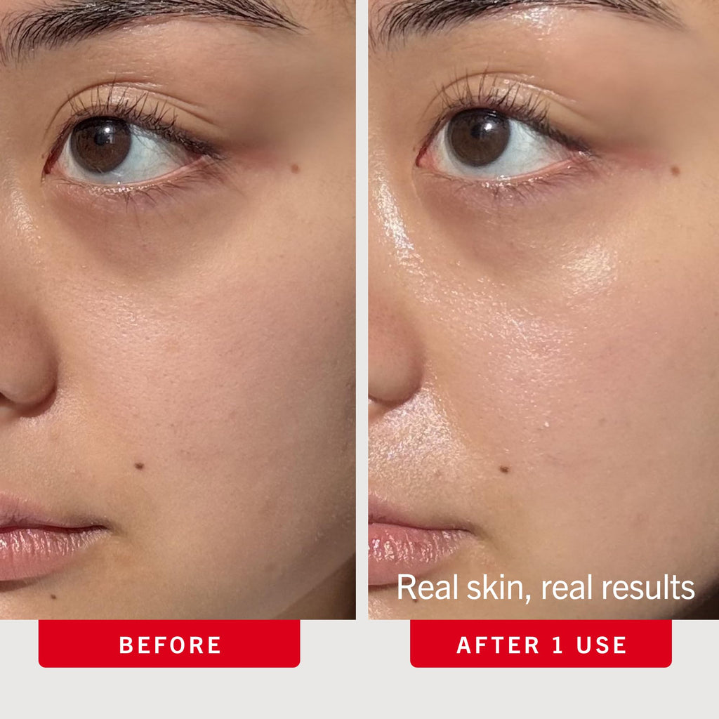 First Aid Beauty - Hydrating Serum with Hyaluronic Acid, Provides 24 Hours of Hydration, Lightweight Formula with Squalane & Colloidal Oatmeal, Safe for Sensitive Skin, 1.7 oz