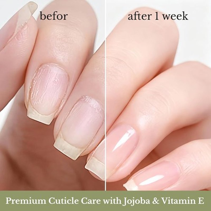 NOVAL Cuticle Oil Roll-On for Men & Women - Travel Size Cedar Scent Nail Care Serum with Jojoba Oil