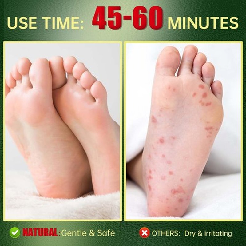 Foot Peeling Mask, Natural Exfoliating Foot Mask, Dead Skin Callus Remover Repair Heels, Hydrating Foot Care for Dry Cracked Feet (6 Pack)