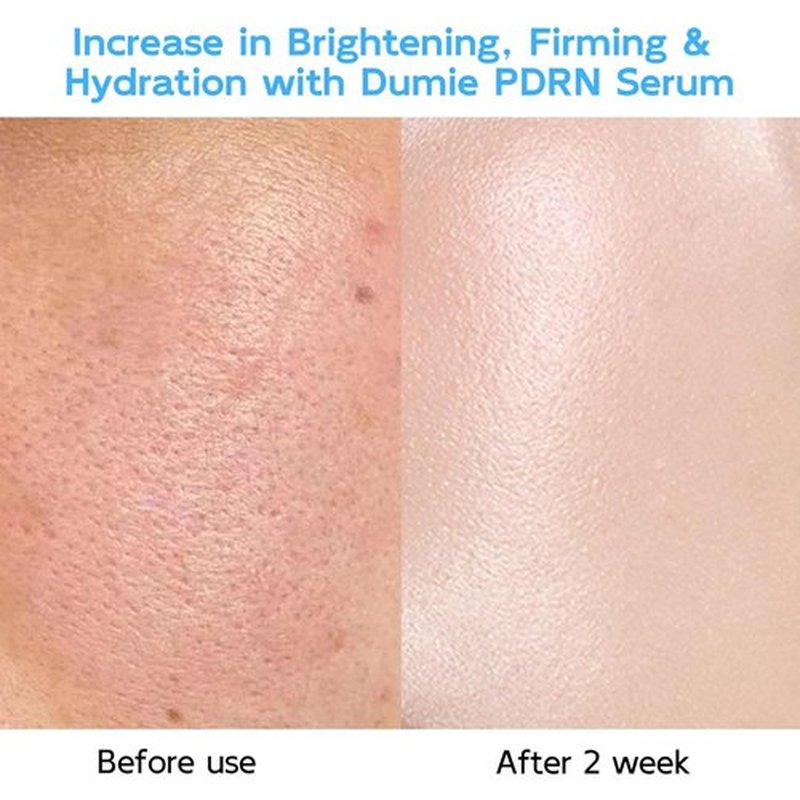 Skiennix Salmon DNA Anti-Aging Serum - 5000ppm Salmon Egg DNA & 2000ppm Collagen | Korean Skincare for Radiance & Wrinkles, 0.05 fl. oz x 30e