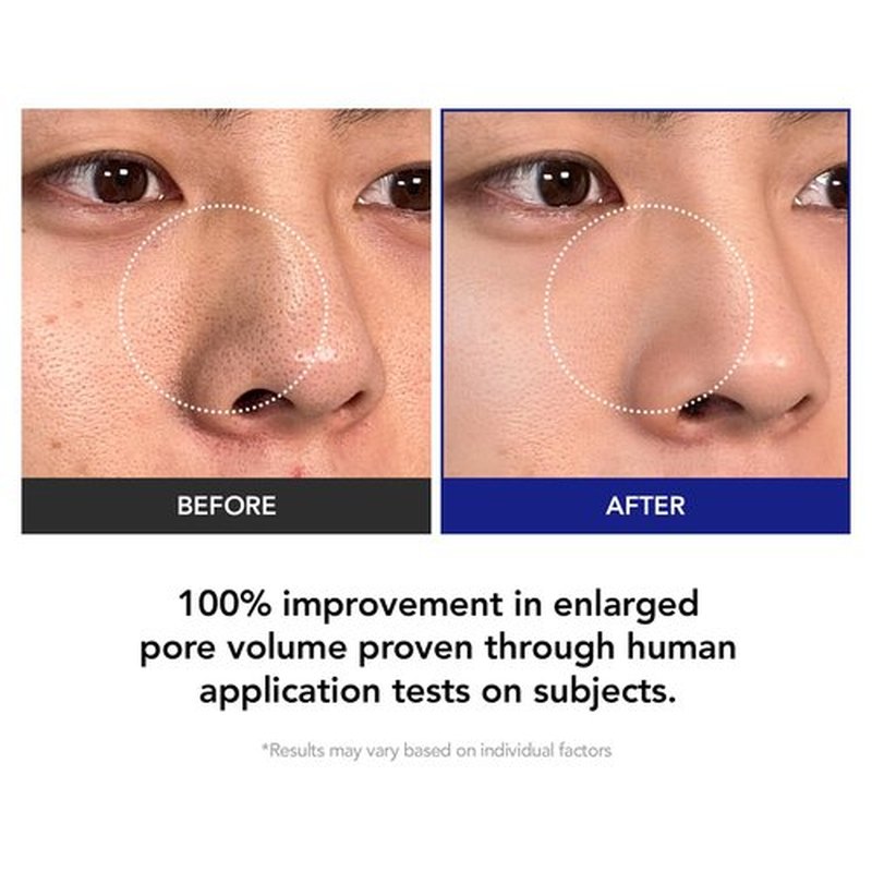 35% Smaller Pores & 32% Reduced Pore Area | Brightening Exfoliating Pads | Soothes, Hydrates & Brightens with CICA Exosomes, AHA/BHA/PHA & Fruit Enzymes | Korean Skincare | 70 Pads