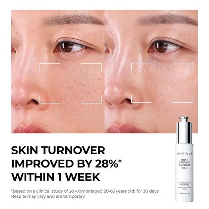 DOMINAS 10% TXA Hyper P-Toning Serum - Brightening & Discoloration Correcting with 5% AHA, 5% Niacinamide | 1.01 fl oz