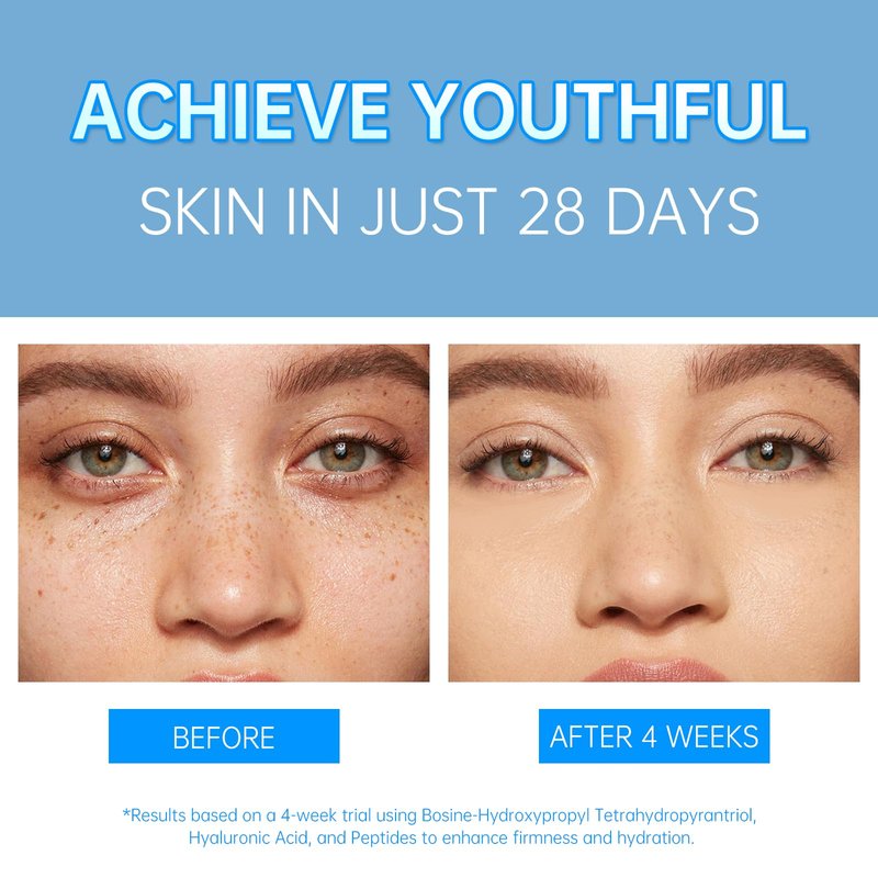VGO Pro-Xylane Active Cream - Plumping & Firming, Daily Face Repair Moisturizer Hydrating for All Skin Types 30g / 1.02oz