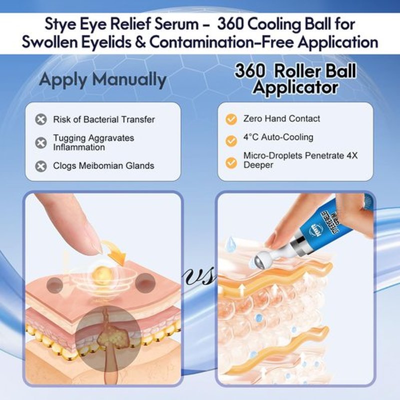 Stye Eye Treatment, Eye Serum for Stye, Chalazions & Blepharitis Roller Serum, Natural and Plant-based Formula (1 Fl Oz)