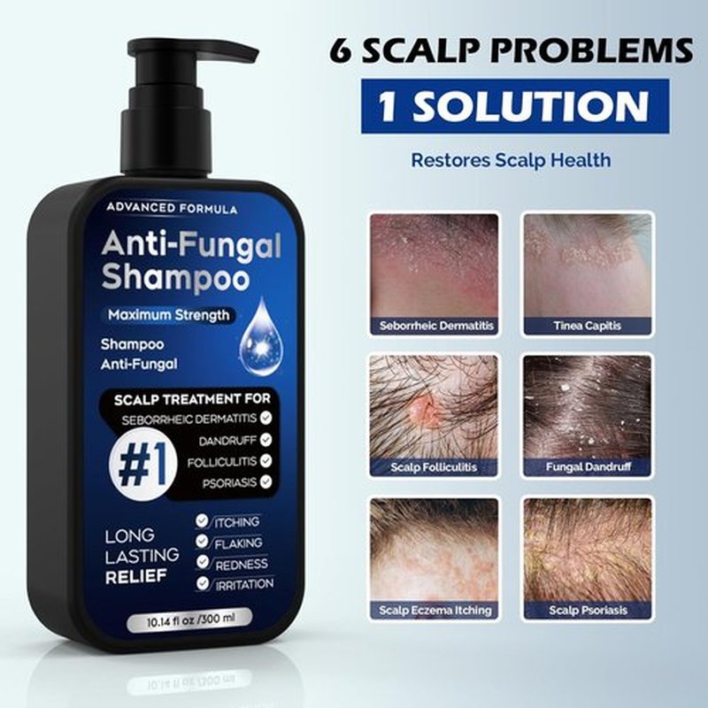 Regine Switzerland Antifungal Psoriasis Shampoo - Relieves Scalp Itching & Dryness | 10.1 Fl Oz