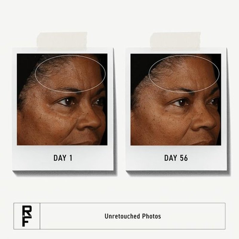 Rodan + Fields Redefine Regimen - Complete Skincare Kit with Clay Cleanser, Toner & Creams | Perfect Gift Set for Women