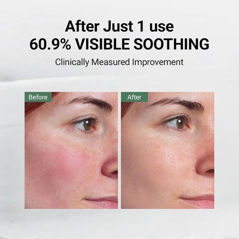 DA EFFECT Post Care Balm - Advanced Barrier Repair Moisturizer & Hydrating Face Cream, 30ml | Soothes Sensitive Skin & Relieves Redness