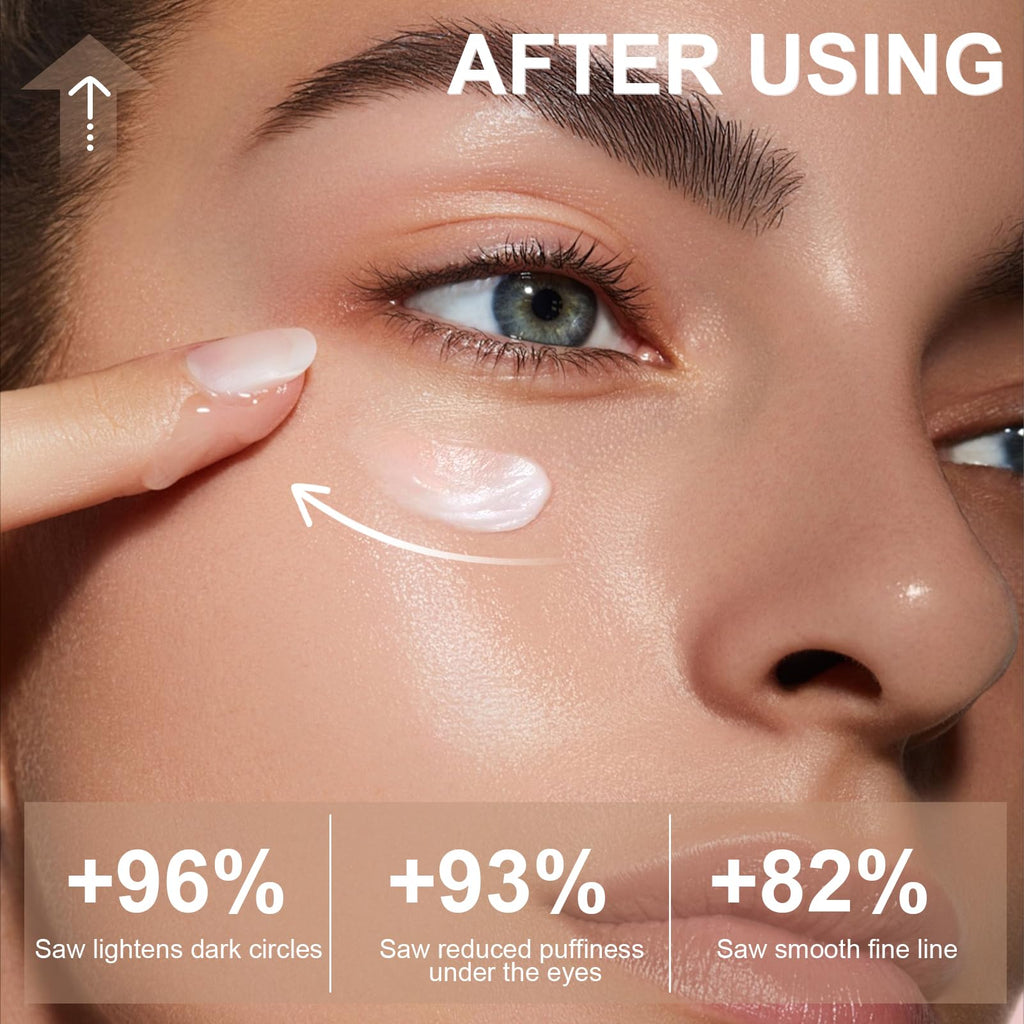 5% Caffeine Eye Cream for Dark Circles Under Treatment Eye Serum for Wrinkles Fine Lines, Retinol Under Cream for Puffiness and Bags with 360° Massage Roller-Ball