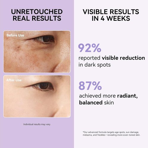 Skiennix Dark Spot Remover Serum - Corrects Sun, Age, & Brown Spots | Evens Skin Tone, 1.7 Fl Oz