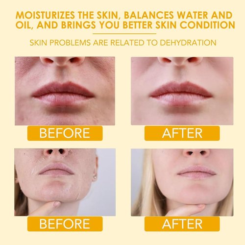 SPVMGRK 2 Packs Beef Tallow for Skin, Tallow and Honey Balm for Face, Organic Grass-Fed Beef Tallow Balm with Raw Wild Honey, Body & Face Moisturizer, Natural Formula (Citrus)