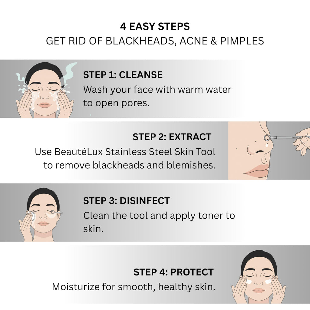 BeautéLux 2-in-1 Blackhead Removal Tool, Stainless Steel Acne Extractor, Blackhead & Whitehead Remover for Face/Nose, Dual-Loop Pimple Extractor, Skin Blemish Tool