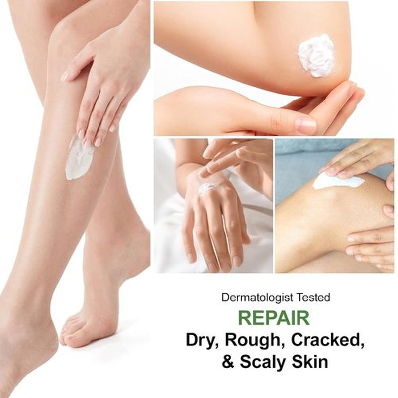 Skiennix Urea Cream 60% - Maximum Strength Foot Lotion with Salicylic Acid & Tea Tree | 5.29oz Intensive Repair