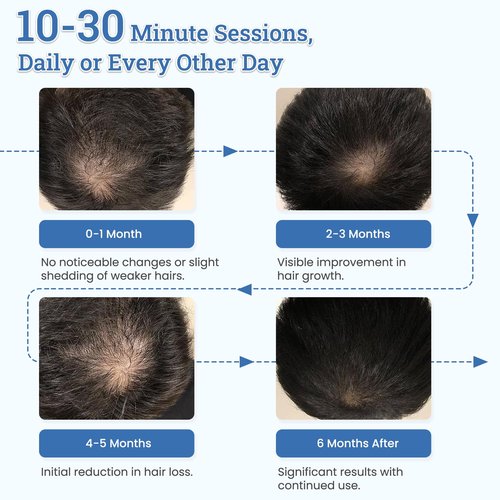 Laser Hair Growth Cap TW316