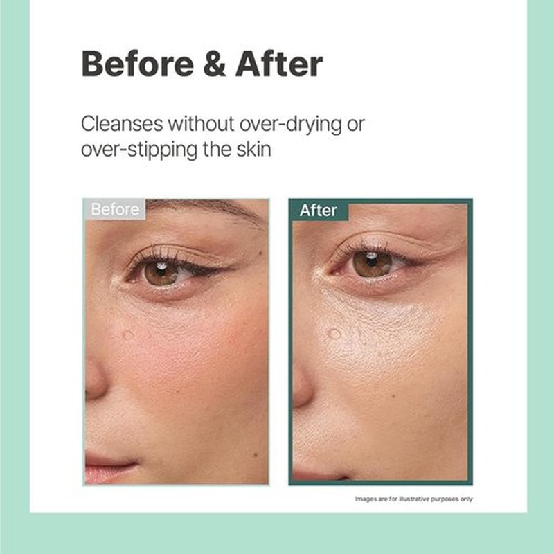 Illiyoon Gentle Deep Facial Cleanser | Low pH Gel-to-Foam Face Wash for Sensitive Skin, Hydrating Gel Cleanser & Daily Makeup Remover, Korean Skincare, 8.45 fl.oz.