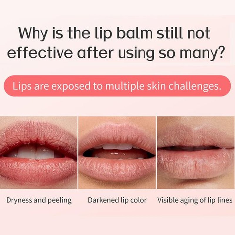 Skiennix Lip Sleeping Mask - Overnight Hydration & Repair for Dry Lips | Vegan, Cruelty-Free, Non-Sticky