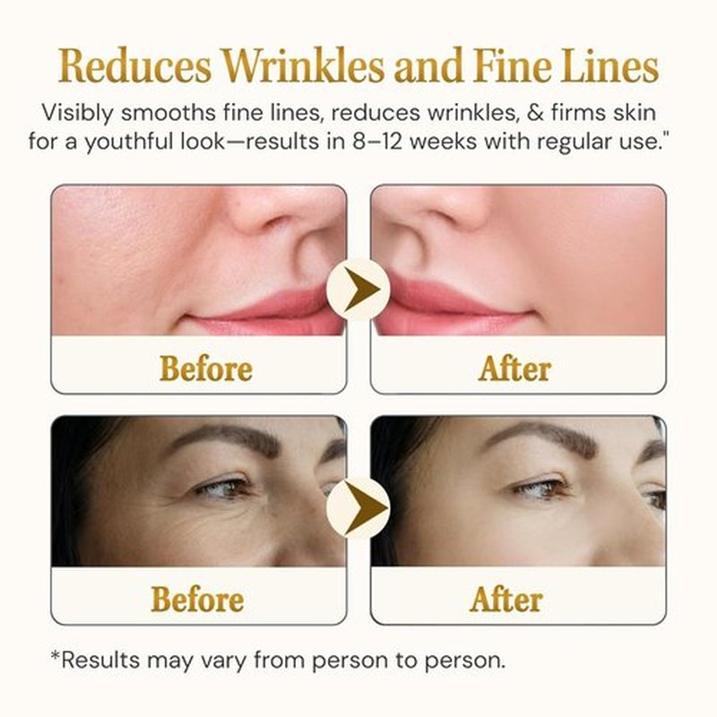 Regine Switzerland Anti-Aging Serum - Matrixyl 3000 with Hyaluronic Acid & Peptide Collagen | Deep Wrinkle Repair, 1.01 Fl Oz