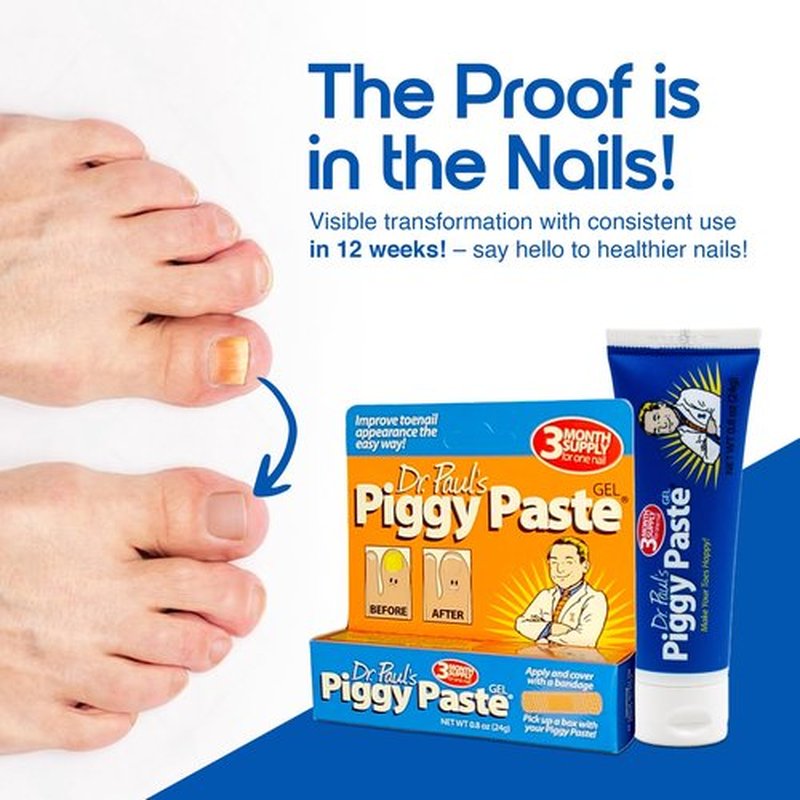 Dr. Paul's Piggy Paste Gel: Fast Acting Solution for Thick, Brittle, Yellow Nails, Restores Clear, Healthy Toenails & Fingernails, Easy, Mess Free Application Doctor Recommended Formula