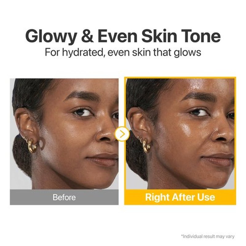 numbuzin No.5 Vitamin Concentrated Serum, Dark Spot Care, Glutathione & Vitamin Serum, Korean Skincare, Tranexamic Acid 4%, Niacinamide 5%, for a Radiant-Looking Glow 1.01 fl oz