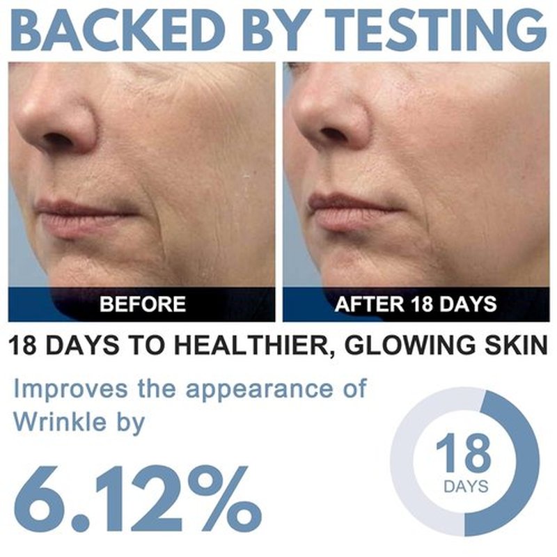 Ribose Cream - Anti-Aging Moisturizer with D-Ribose & Coconut Oil | Tightens & Firms Skin, 2.5 oz