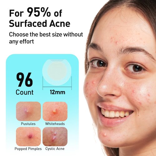 TKTK Pimple Patches, 12mm Invisible Acne Patches for Face with Salicylic Acid, 0.01cm Extra Thin Outer Edge, Hydrocolloid Zit Patch for Pustule, Whitehead, Cystic Acne Spot, 96 Count