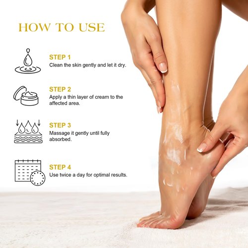 ASDToTio Urea Cream 40% - Foot Care for Dry Cracked Heels, Foot Lotion - With 2% Salicylic Acid, Tea Tree Oil, Shea Butter, Aloe Vera - For Feet, Hands, Heels, Elbows, Knees and More - 6 oz