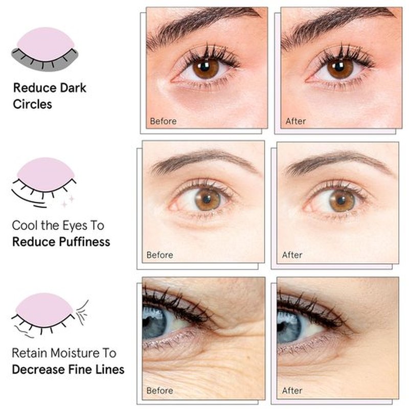 Grace & Stella Under Eye Mask Variety Pack - 18 Pairs of Gel Patches for Dark Circles | 6 Colors - Perfect Mother's Day Gift for Women