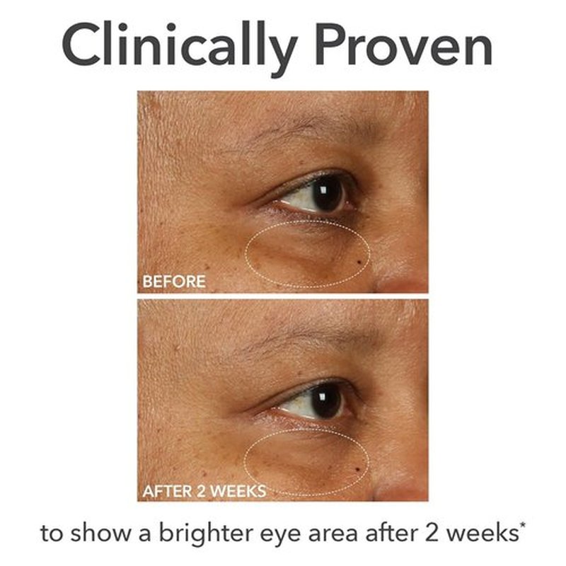 Dr. Dennis Gross DermInfusions Eye Cream - Hydrating & Brightening Treatment for Dark Circles, 0.5 Oz