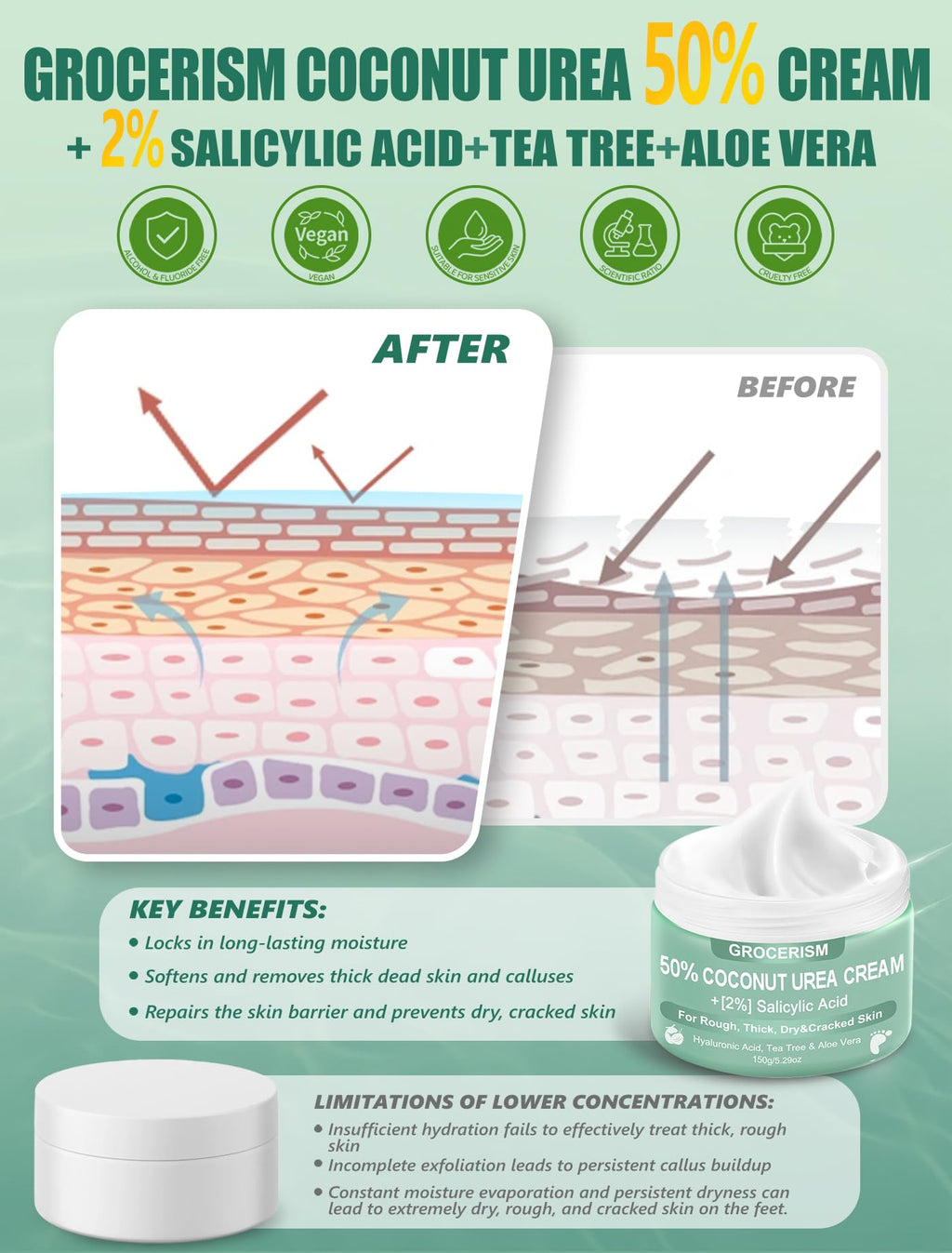 Urea Cream 50 Percent for Feet with Coconut 5.29 oz || Foot & Hand Cream Maximum Strength with 2% Salicylic Acid, Tea Tree and Aloe Vera for Deep Moisturizing and Callus Removing (Upgraded Formula)