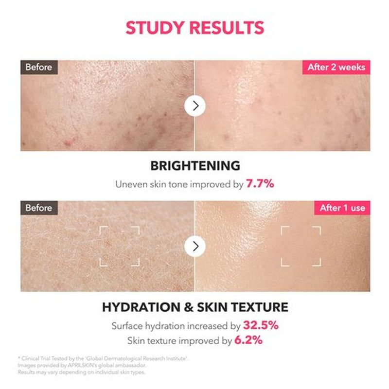 APRILSKIN TXA+Niacinamide 99 Pink Milky Toner | 99% High-Purity TXA 3%+ Niacinamide 5% for Brightening | Highly Concentrated Cream Toner | Deep Moisturizing Formula for Dull Skin | 5.07 fl.oz.