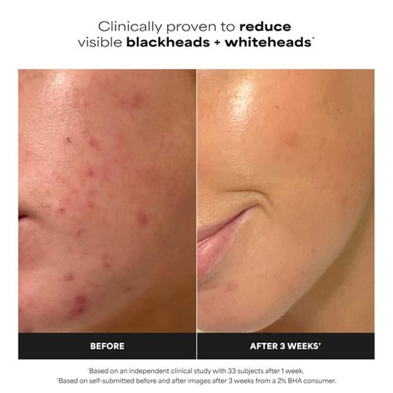 Paula's Choice SKIN PERFECTING 2% BHA Exfoliating Pads - Clear Blackheads & Minimize Pores, 60 Count