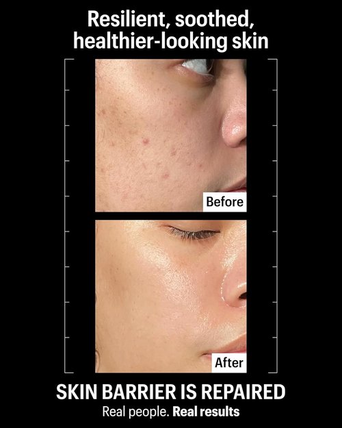 Allies of Skin Molecular Barrier Repair Cream Balm - Deeply Hydrating Face Moisturizer with Ceramides & Squalane | 1 fl oz for Irritated Skin Relief