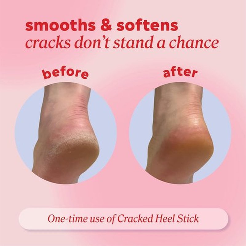 Onyx Professional Cracked Heel Repair Balm Stick - Moisturizing Coconut Scent for Dry Feet, 1 Pack