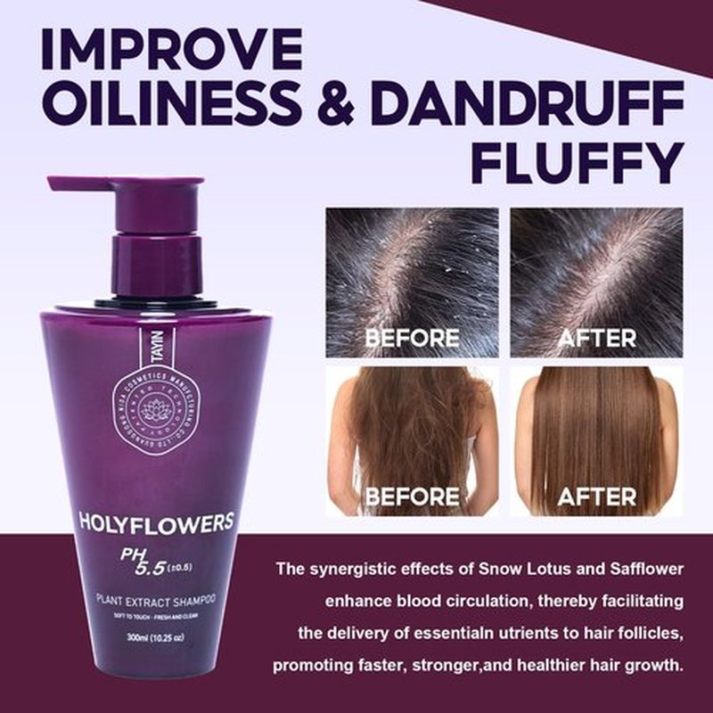 Holyflowers Dandruff Shampoo for Chemical Free | Herbal Essence | Acidic Bonding Concentrate | For All Hair Types | Damaged Scalp Repair