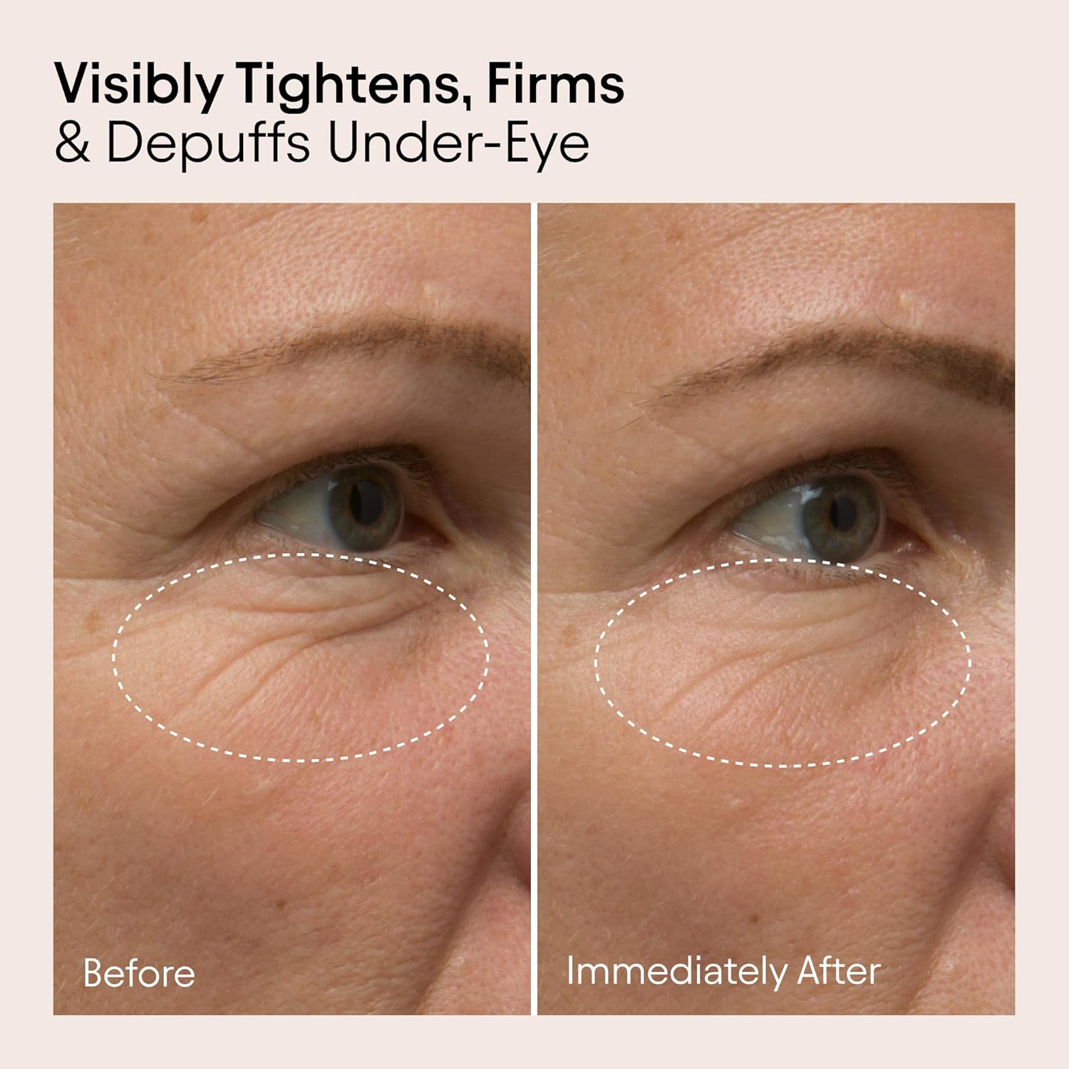 Alpyn Line-Filling Eye Balm - Bakuchiol & Caffeine Formula to Reduce Fine Lines | 0.5 oz / 14 ml