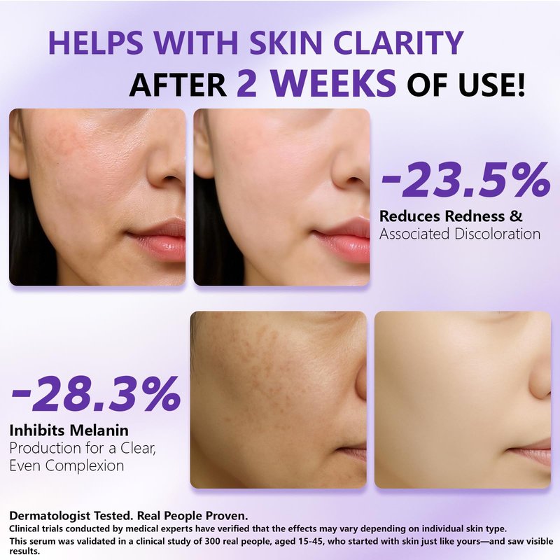 YUFUY 14% Tranexamic Acid Niacinamide Serum 30ML, Korean Facial Glass Skin Care Centella Serum Dark Spot Corrector Cream, Reduces Pigmentation Uneven Skin Tone, Pore Care for Sensitive Skin 1.01 FL.OZ
