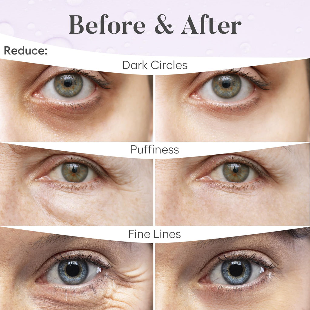 AURAE Retinol & Collagen Under Eye Patches (30 Pairs) - For Dark Circles & Puffy Eyes - Eye Care Mask