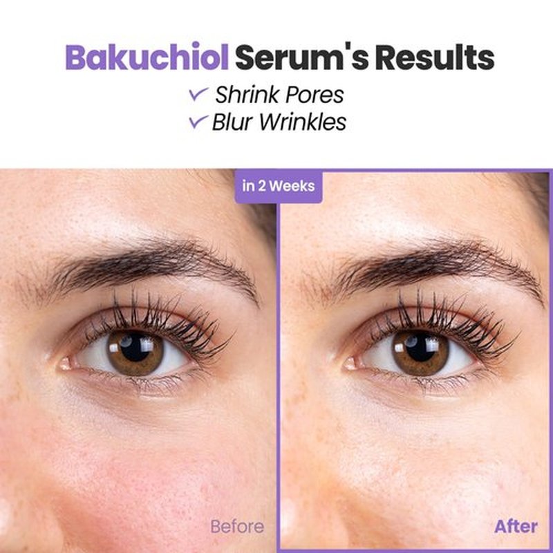 Glam Up Bakuchiol Serum - Anti-Aging Retinol Alternative with Hyaluronic Acid | Hydrate & Blur Fine Lines (1.01 Fl Oz)