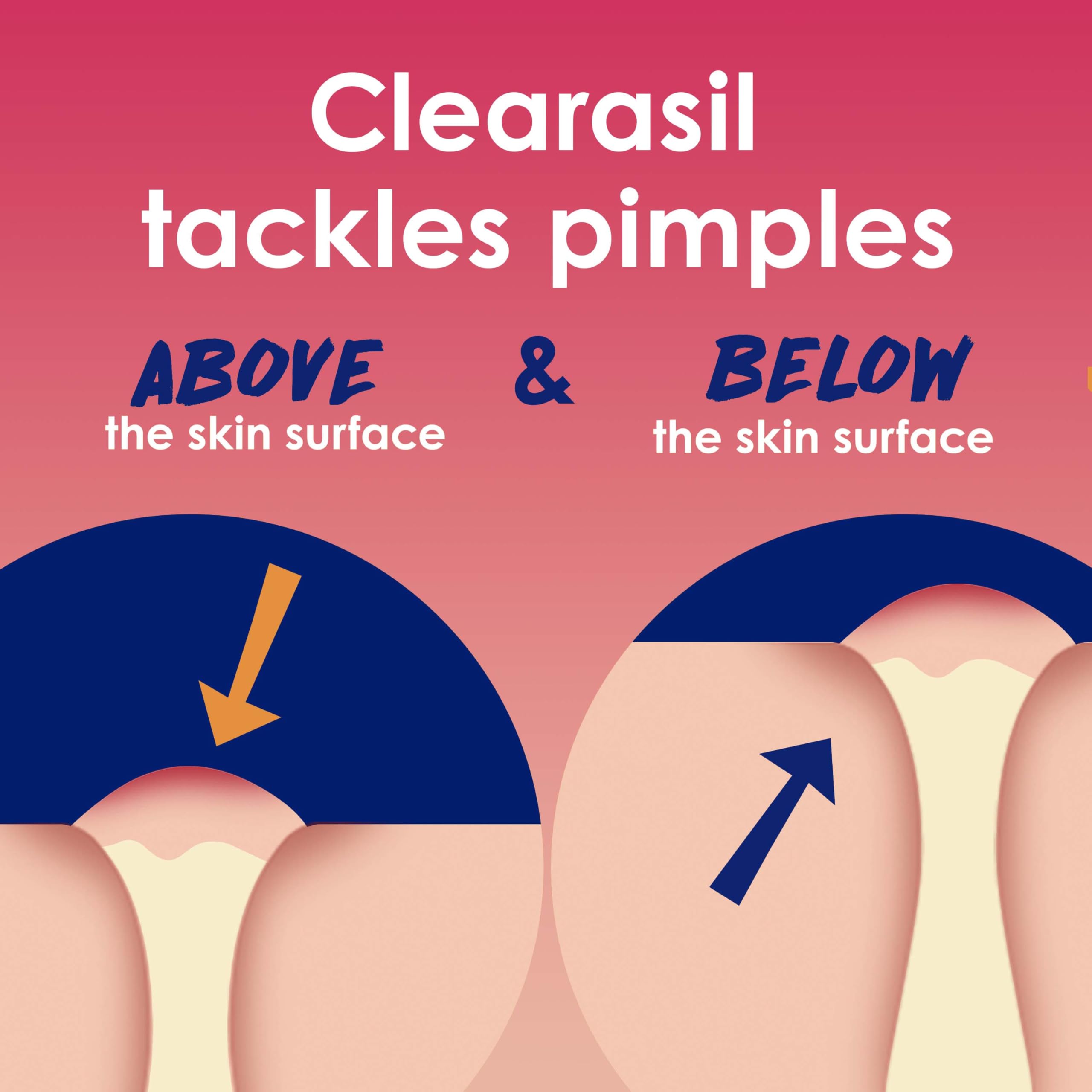 Clearasil Rapid Rescue Deep Treatment Acne Face Pads, Maximum Strenght with 2% Salicylic Acid Acne Treatment Medicine, 90 Count