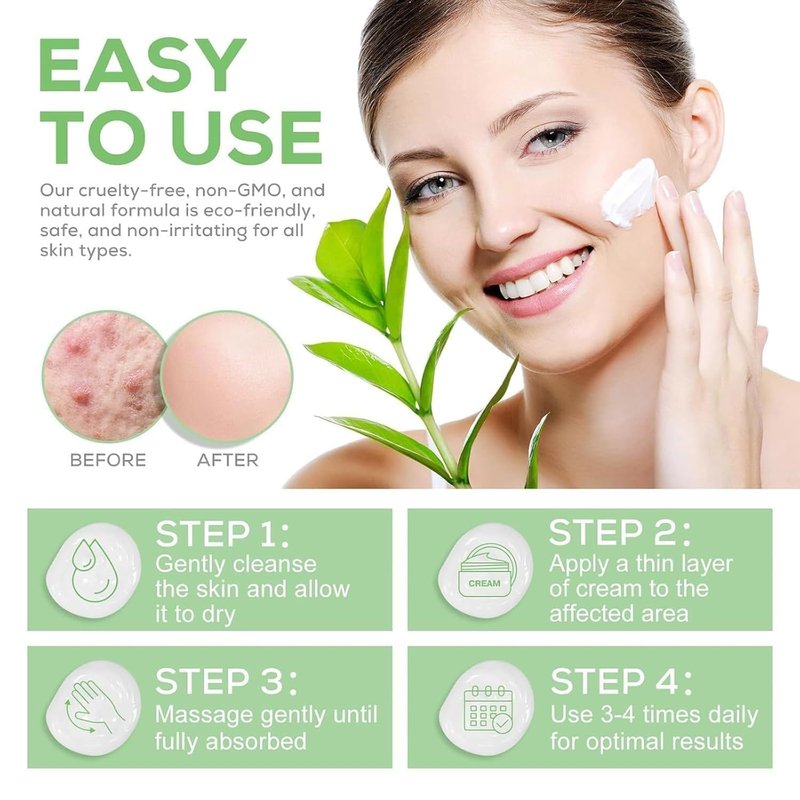 Urea Cream 40 Percent Plus 2% Salicylic Acid, 40% Urea Cream Suitable for Rough and Cracked Skin on Heels Ankles and Knees Deeply Moisturize Exfoliate Soften and Loosen Dry Callused Skin-4.23 Oz(120g)
