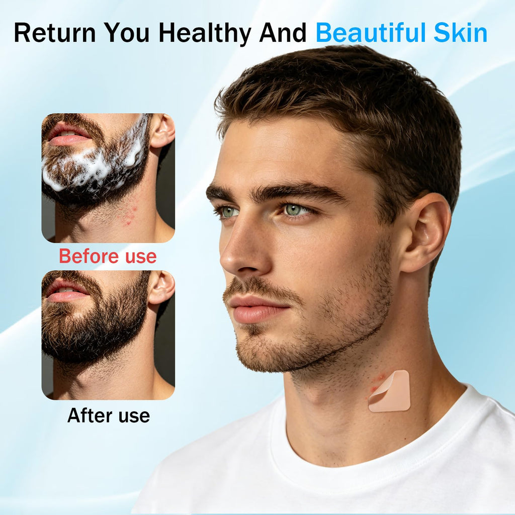 Ingrown Hair Treatment Patch, 72 Pcs Razor Bump Treatment for Bikini Area, Smooth-Feeling Non-Irritating Formula, Ingrown Hair Pads & Pubic Hair Cyst Treatment for Women & Men