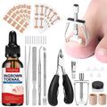 Ingrown Toenail Removal Kit, Ingrown Toenail Tool Kit with Ingrown Toenail Corrector, Ingrown Toenail Drops, Corrector Patch, Toenail Clipper, Nail File Lifter Tools