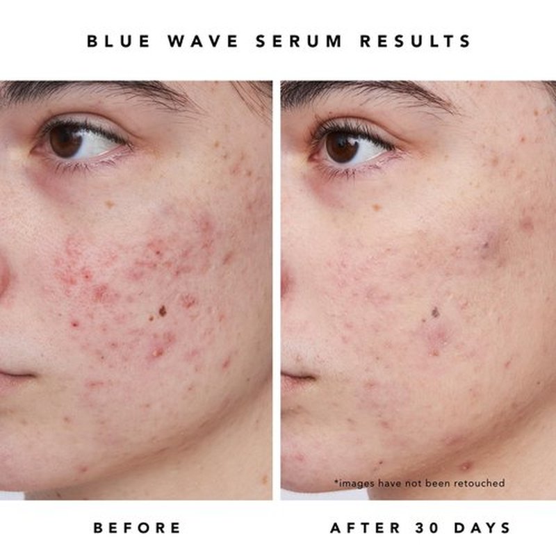 HERBIVORE Blue Besties Duo – 2-Step Treatment for Acne-Prone Skin, Aquarius Cleanser (50 mL) & Blue Wave Serum (10 mL), Plant-Based, Vegan, Cruelty-Free