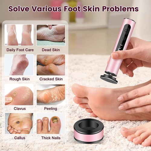 EFCRBS Electric Foot Callus Remover with LED Battery Level & 9-Speed Control Display. Callus Remover for Feet with Wireless Charger, Multi-sandpape (70 Sheets) & Nano Glass Head for Dead Skin (Pink)