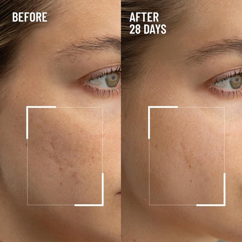 Dr. Brandt Microdermabrasion Exfoliator - Revitalize Dull Skin & Reduce Fine Lines - 2.0 oz
