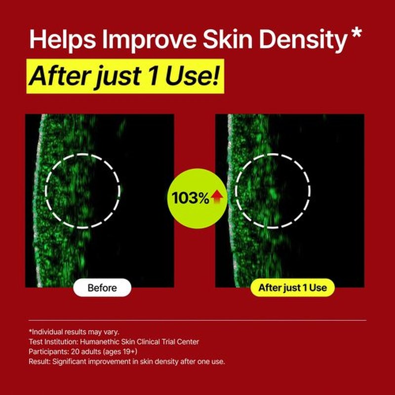 AINOHEA Chaom Balancing Dermaclera Active Serum – Glassy Glow Serum for Fine Lines, Radiance & Skin Elasticity, Anti-Aging Facial Serum, Milky Texture, for Firmed &Youthful Skin, Korean Skincare, 55ml
