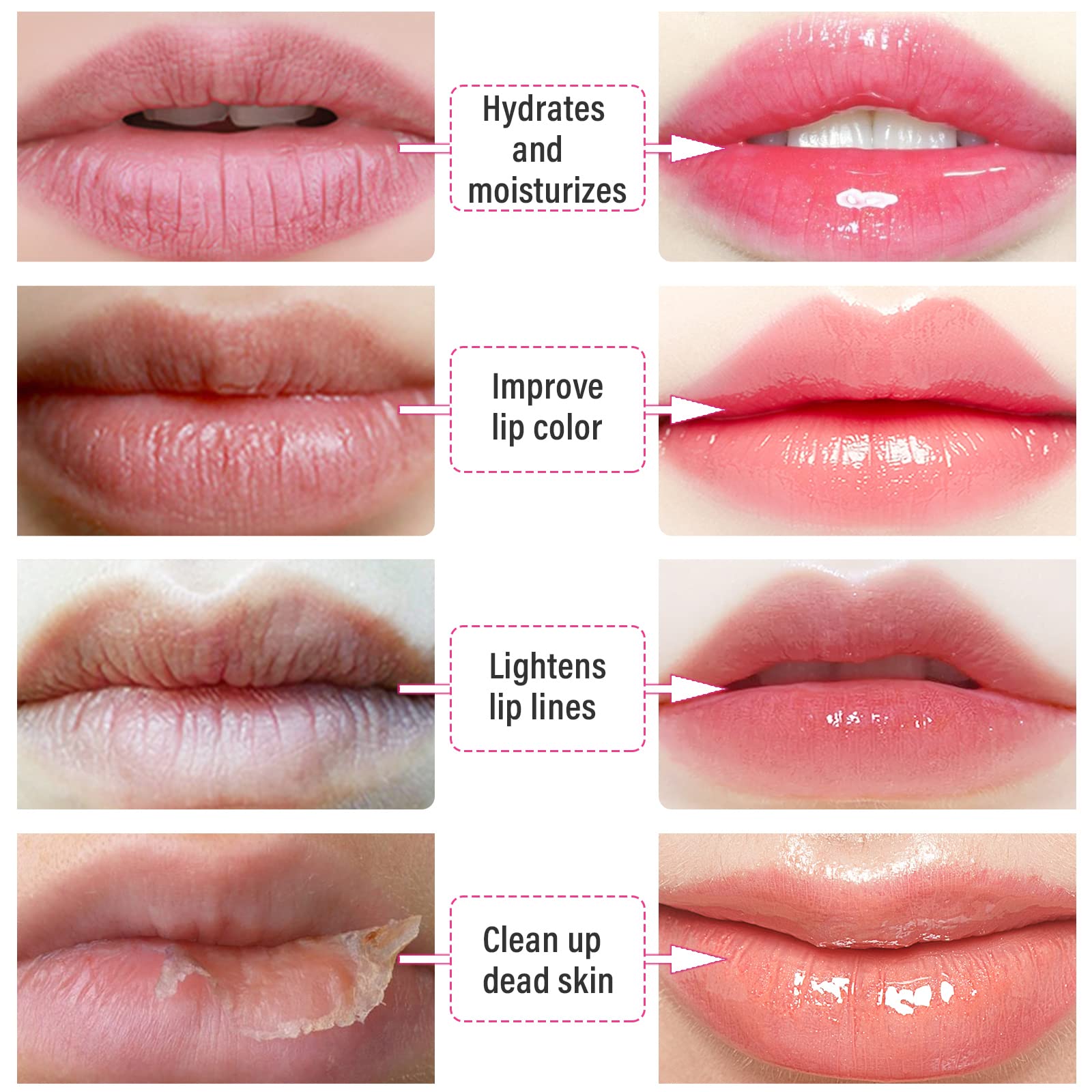 REENGULL Collagen Lip Mask Patches (30 Pairs), Hydrating Hydrogel Lip Treatment for Dry Lips, Plumping & Anti-Wrinkle Lip Care, Non-Slip Fit for Mothers Day Gifts,Teacher Appreciation Gifts