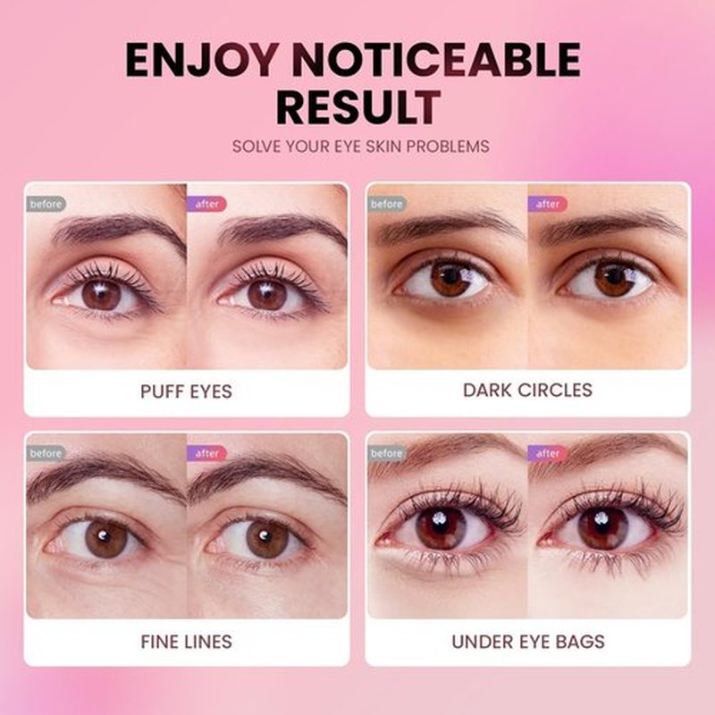 AILEORY Under Eye Patches (24 Pairs) - Tri-color Glitter Eye Gel Pads for Dark Circles, Puffy Eyes, Under eye Bags, Wrinkles | Natural Collagen Under Eye Mask Patches, Easter Basket Stuffers