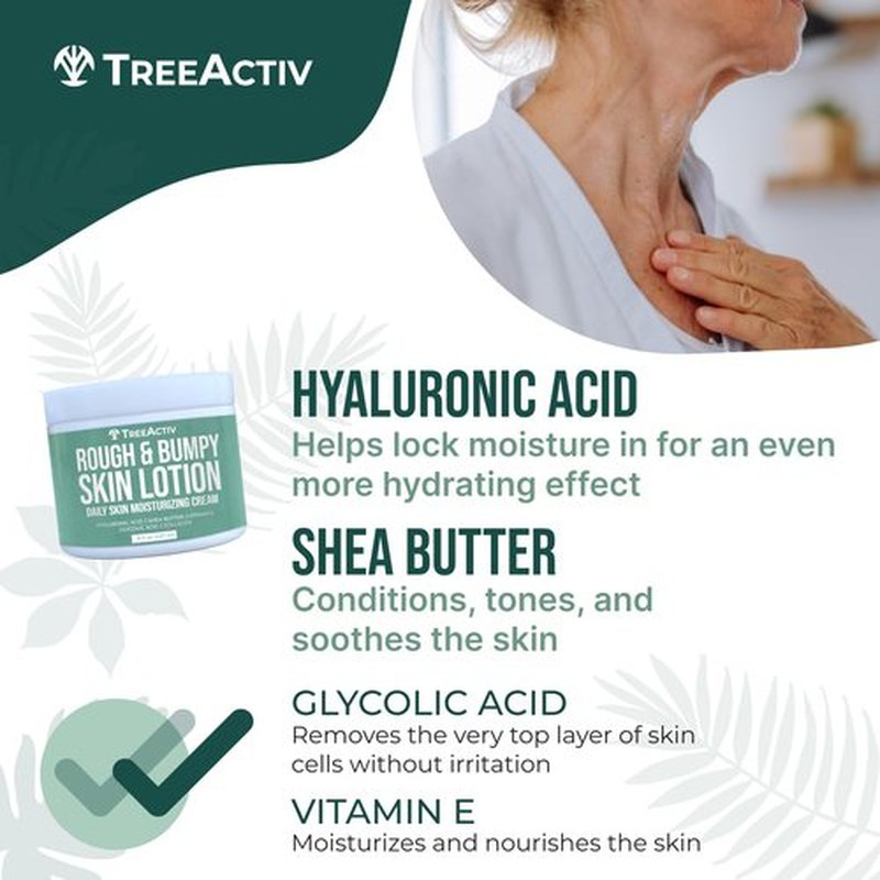 TreeActiv Rough and Bumpy Skin Lotion, 8 fl oz, With Hyaluronic Acid, Shea Butter and Vitamin E, Nourishing Lotion for Rough and Bumpy Skin, Moisturizing Strawberry Legs, For All Skin Types