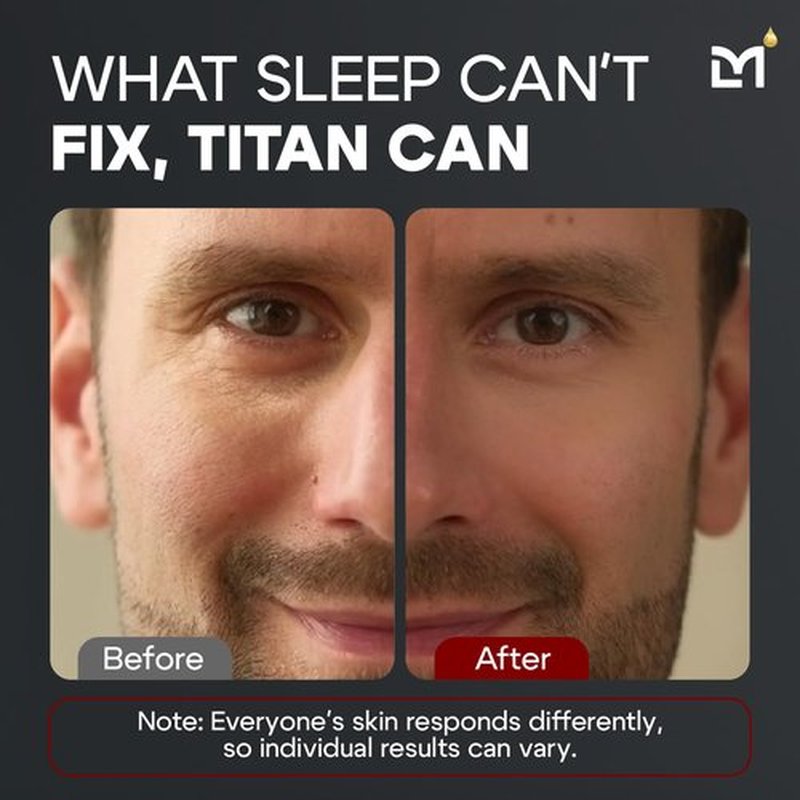 Man Labs Titan Men's Eye Cream - Anti-Aging Treatment for Dark Circles & Eye Bags - Peptides & HA - Unscented
